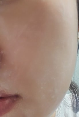 애드랩 이미지