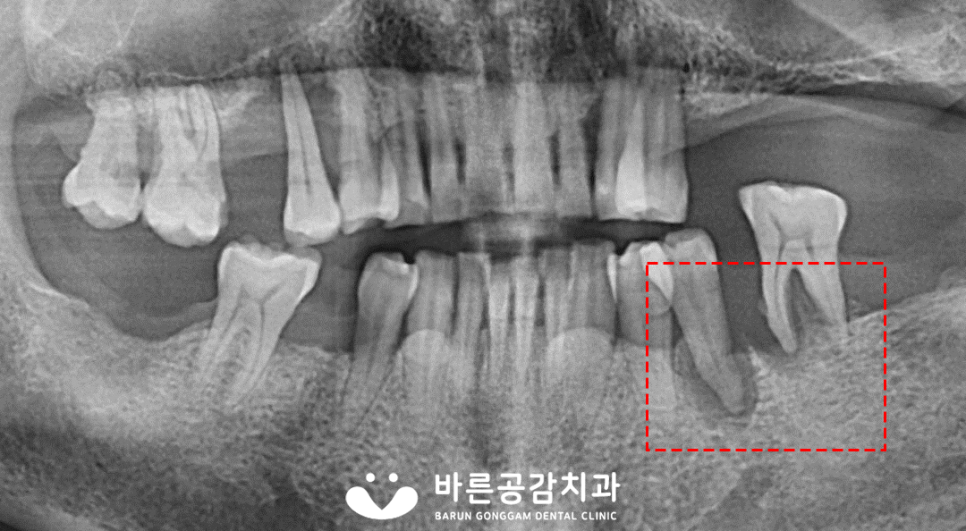 바른공감치과의원 이미지