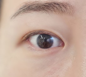 하이.롬블리 이미지