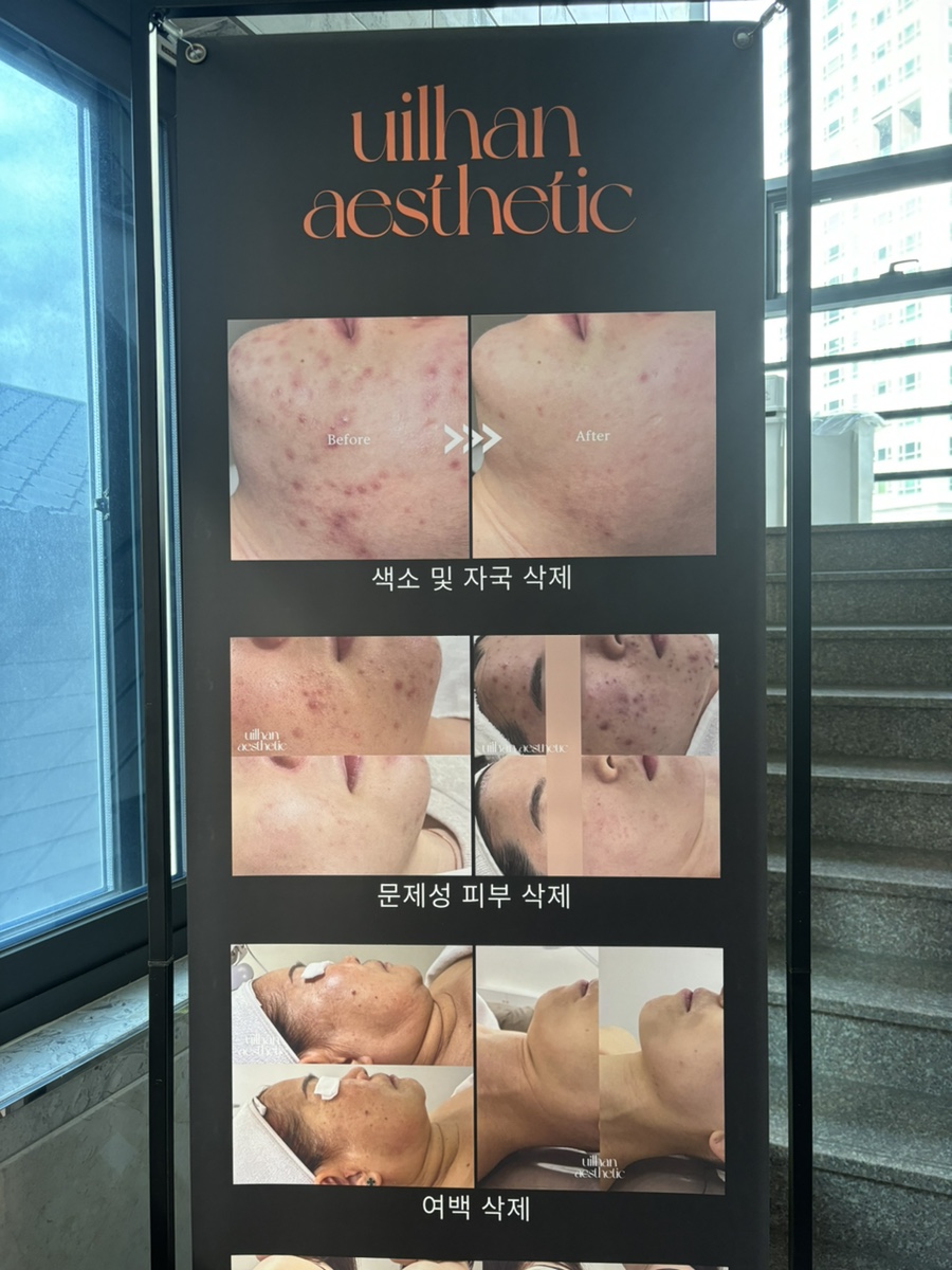 헤리쉬 이미지