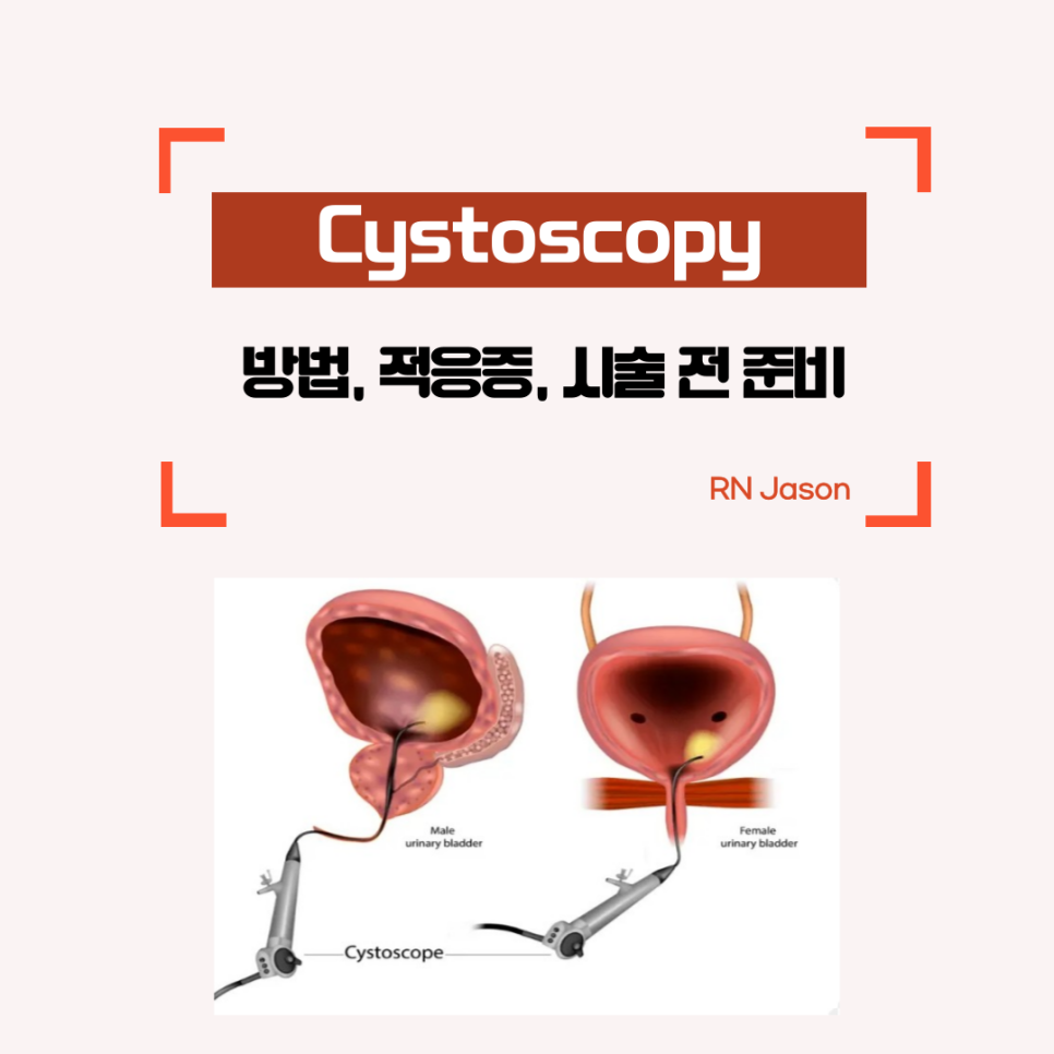 방광경검사(Cystoscopy): 방법, 적용증, 시술 전 준비에 대해 알아봐요~ : 네이버 블로그