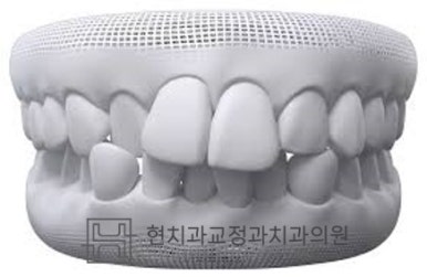 현치과교정과치과의원 이미지