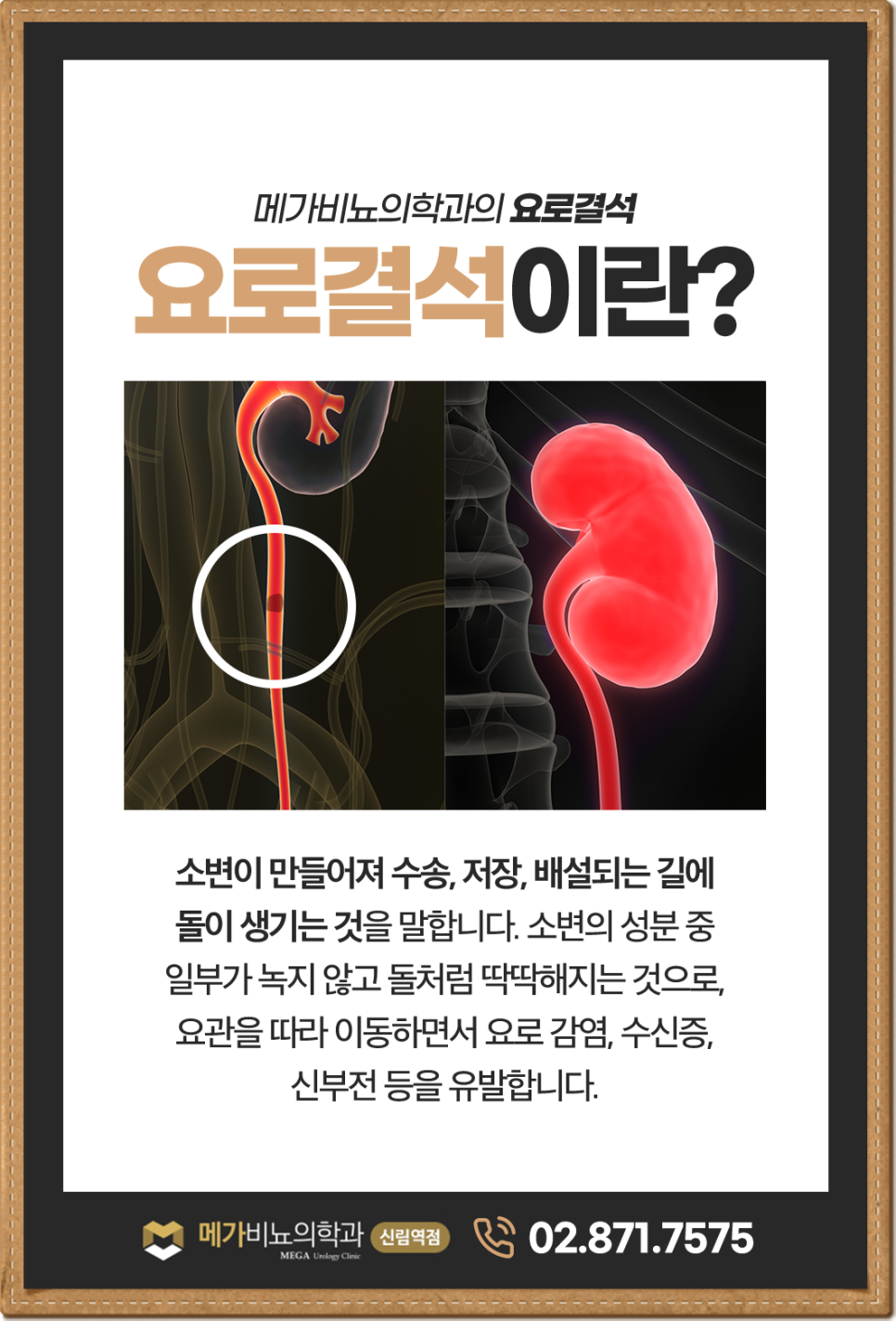 메가비뇨의학과 이미지