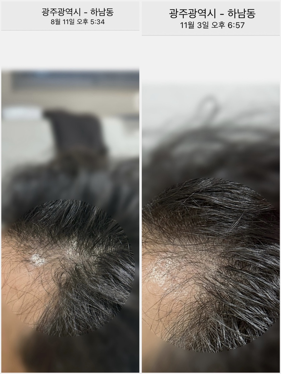 에코레비헤어헤드스파광주 이미지