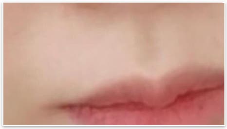 더봄구강악안면외과치과의원 이미지