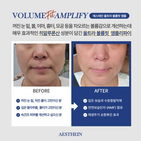스페셜핏 이미지