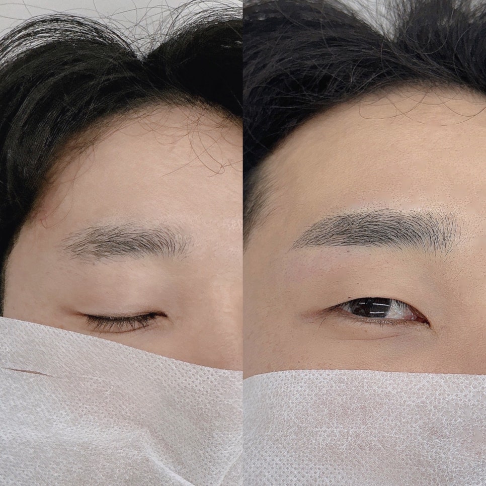 토끼눈썹 이미지