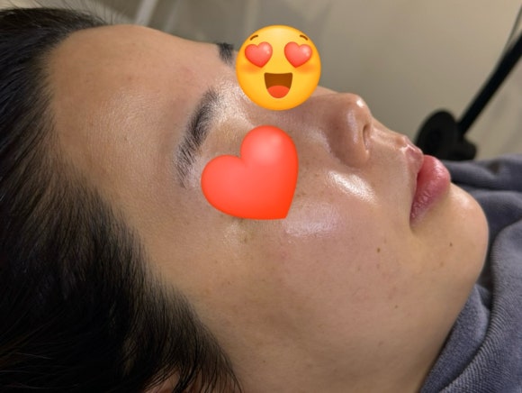 래시베이 이미지