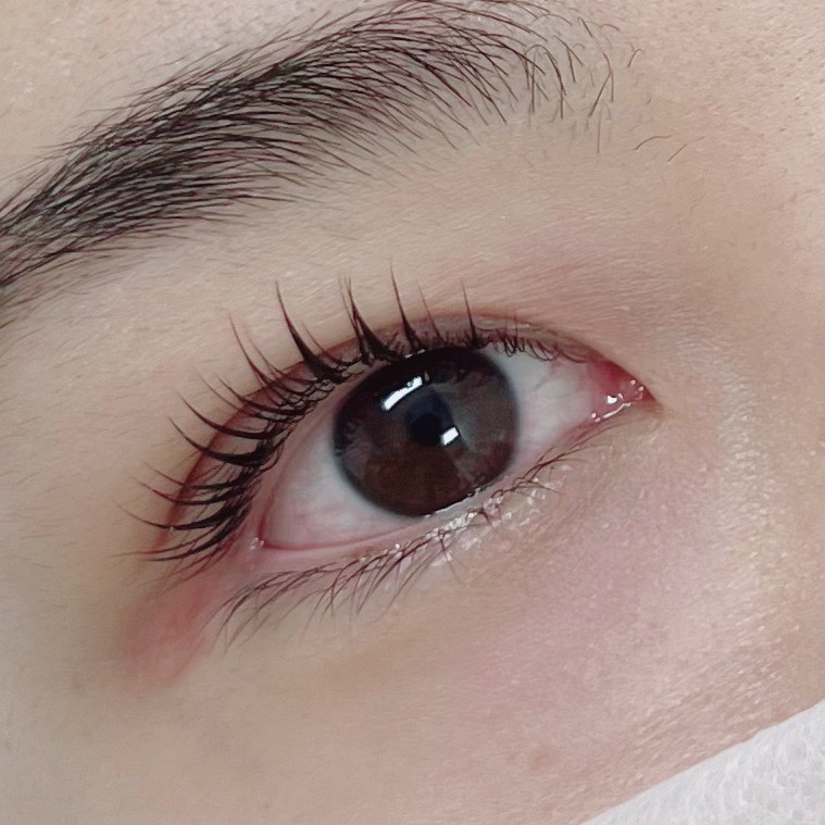 로로아로 이미지
