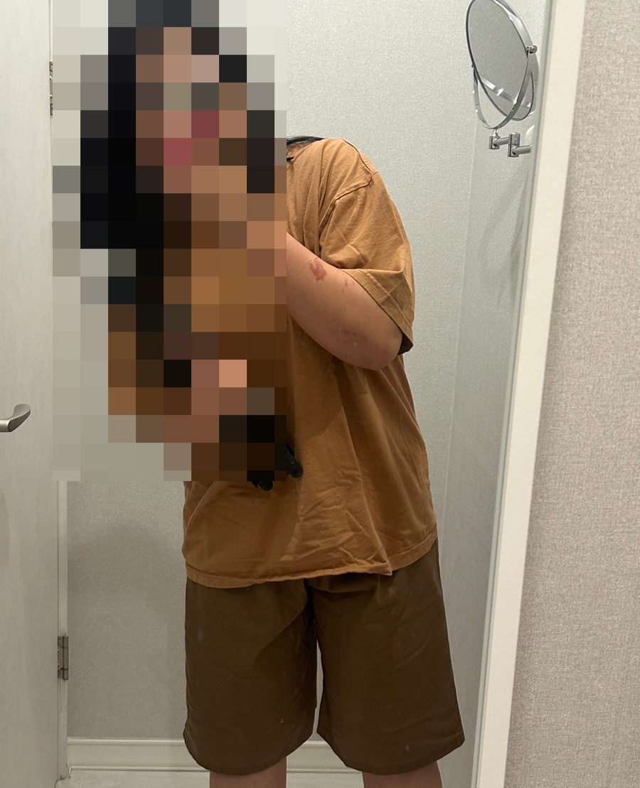 프로아풋앤바디 이미지