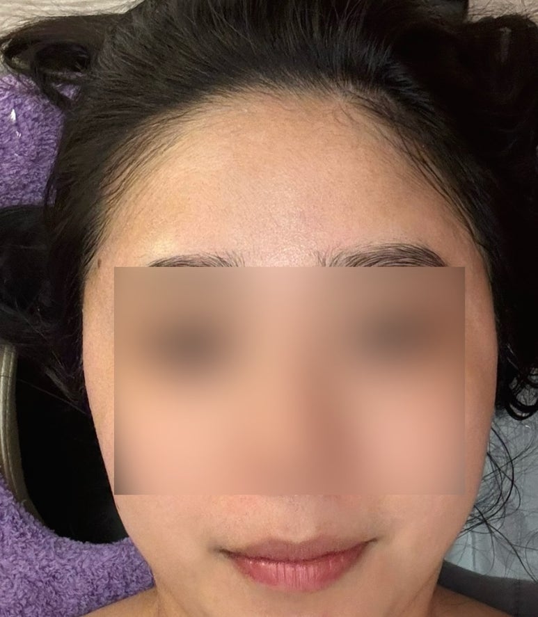 스킨바 수지성복점 이미지