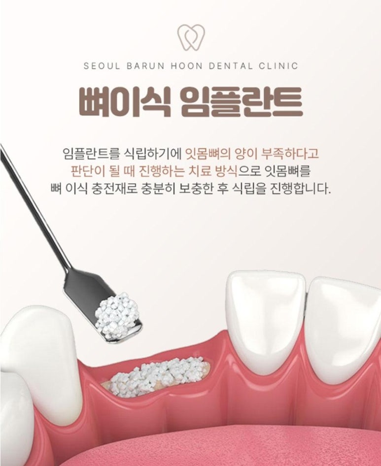 서울훈치과의원 이미지