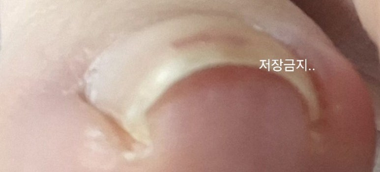 내성광고 이미지