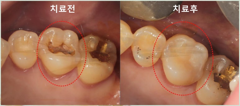 하남본치과 이미지
