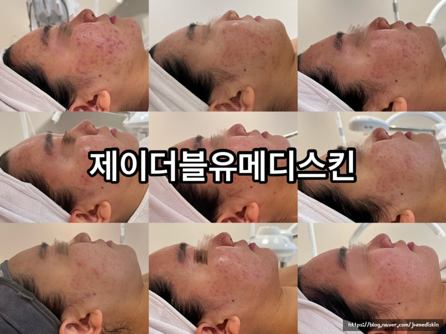 제이더블유메디 이미지