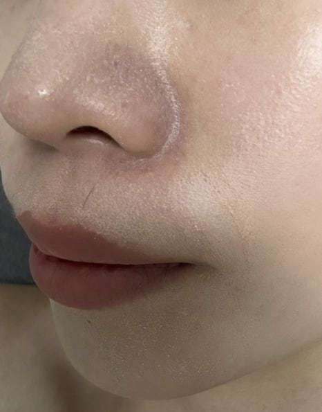 안나테라피 이미지