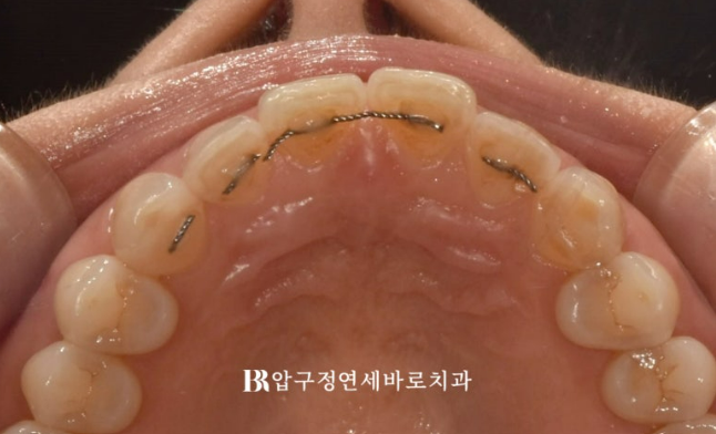 젤라 이미지