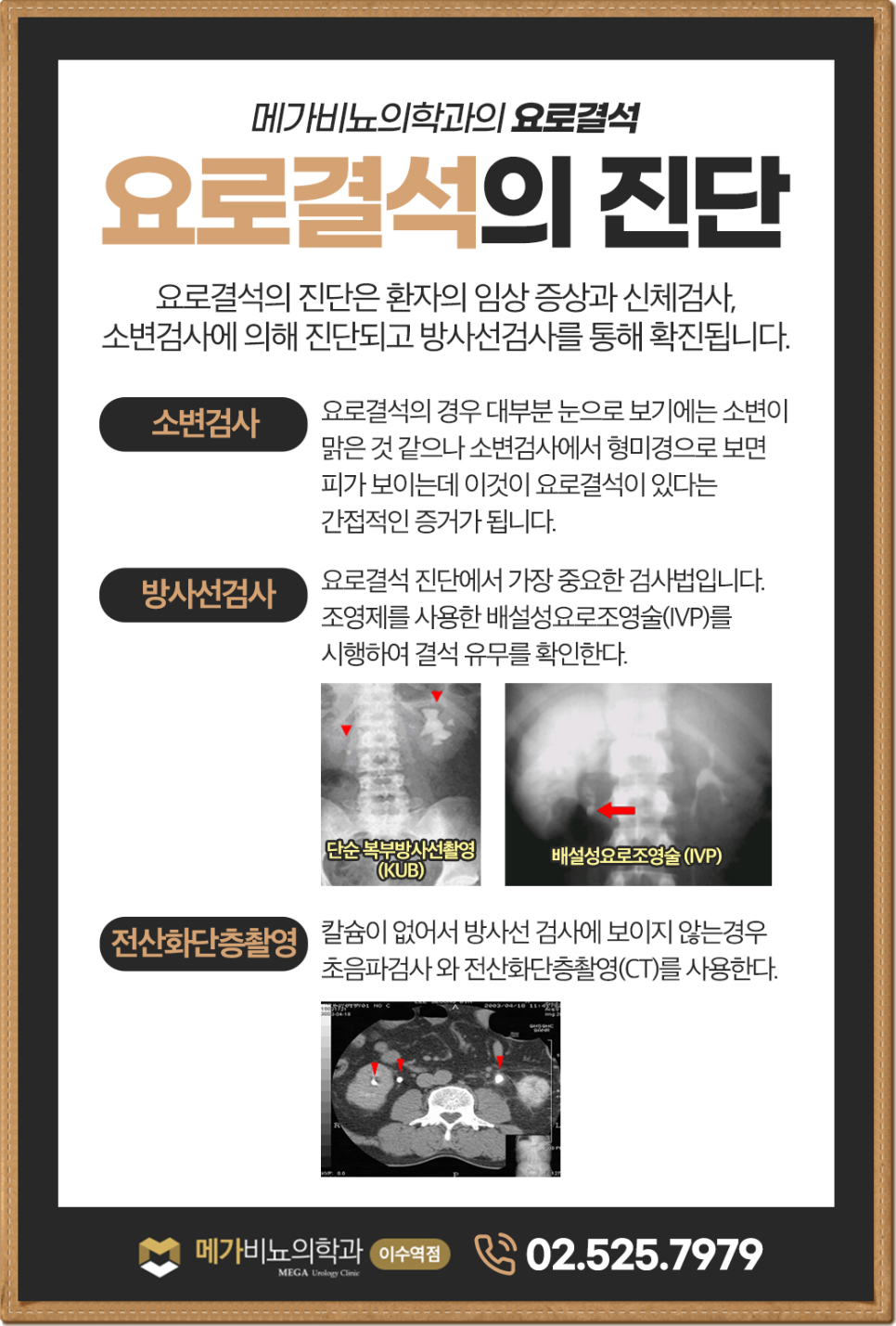 메가비뇨의학과 이미지