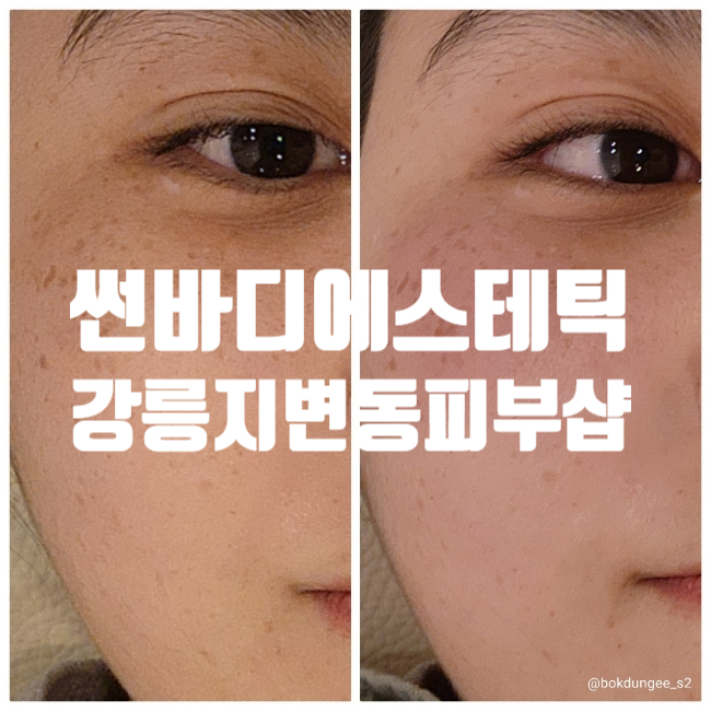 썬플라토 이미지