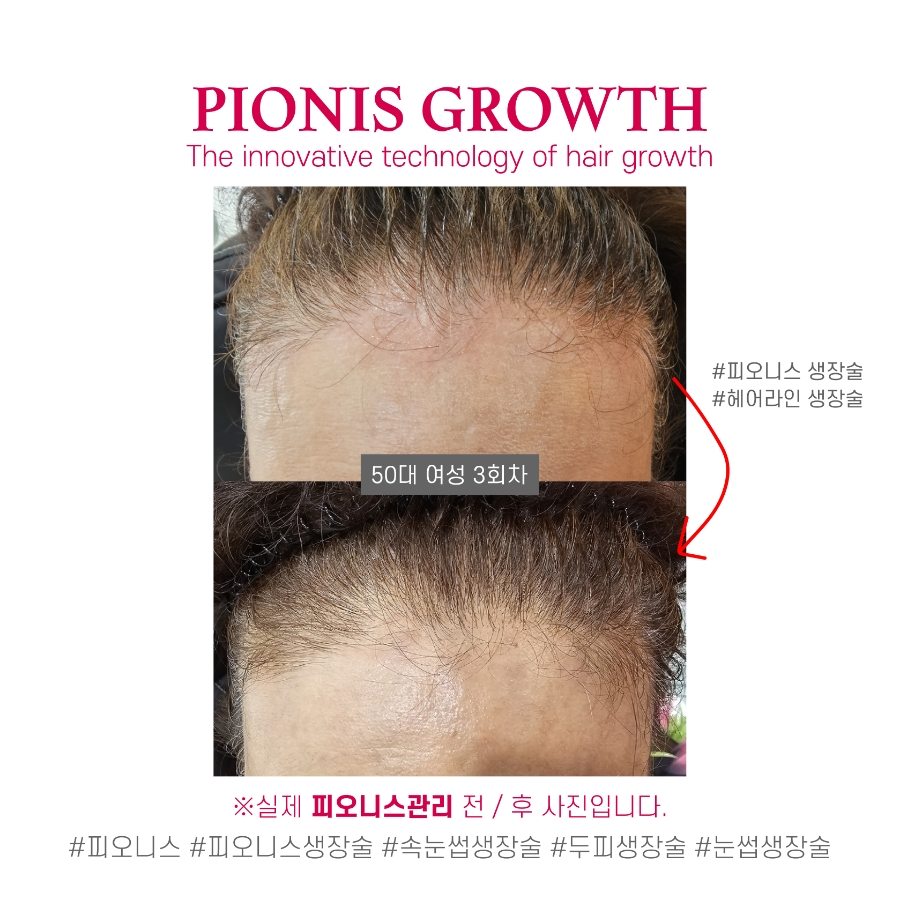 피오케이 이미지
