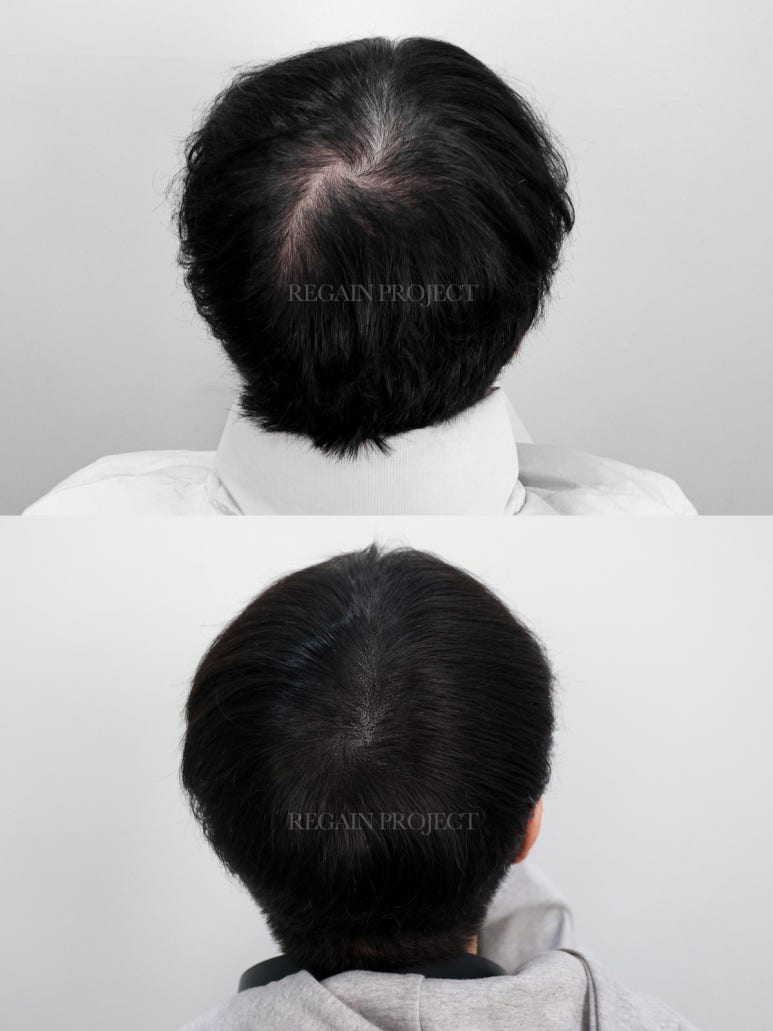 커리어도트 이미지
