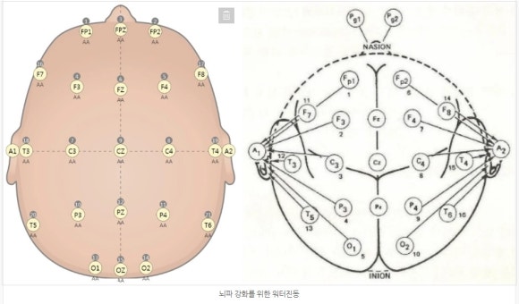 경혈테라피 이미지