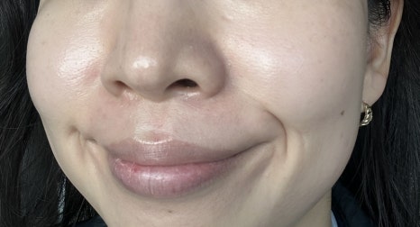 안나테라피 이미지