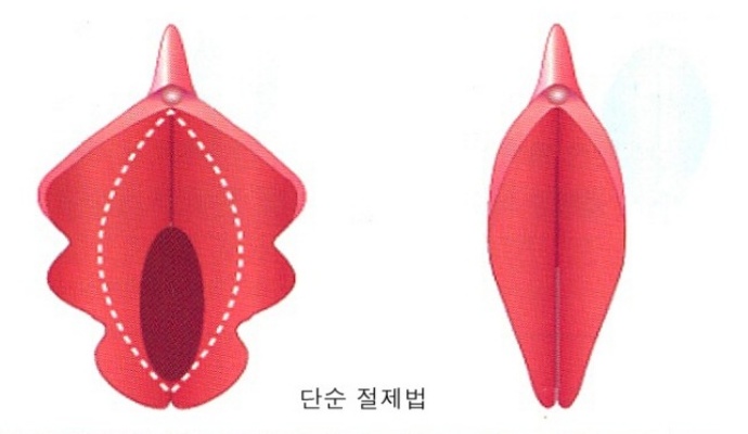 에스의원 이미지