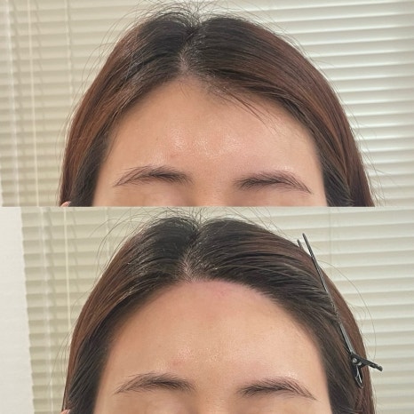 헤어아르니 이미지