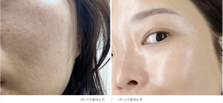 뷰티 썸 스킨 이미지