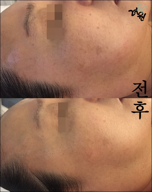 려원스킨케어 이미지