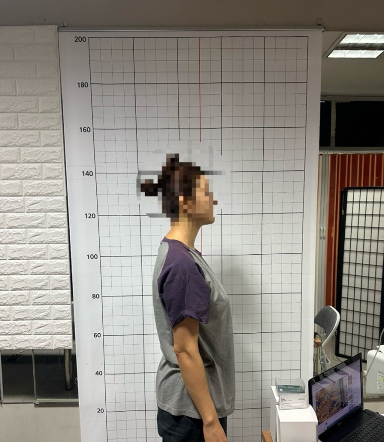 거부기전자 이미지