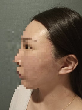 젤성형외과의원 이미지