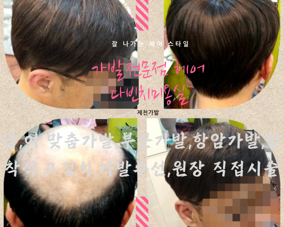 제천가발 이미지