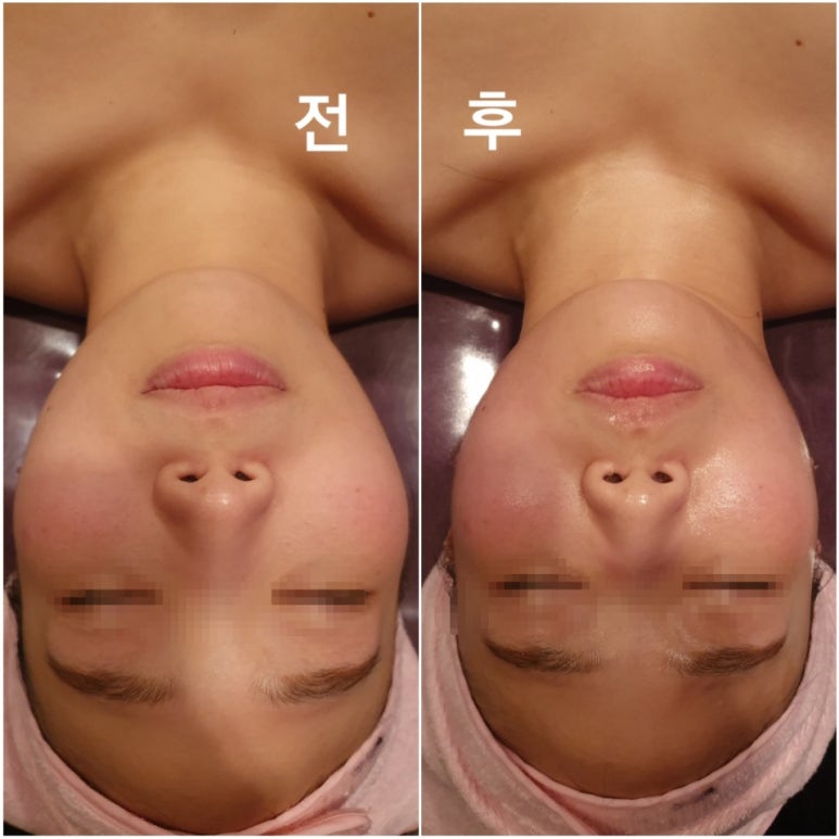 피부,맑음 이미지