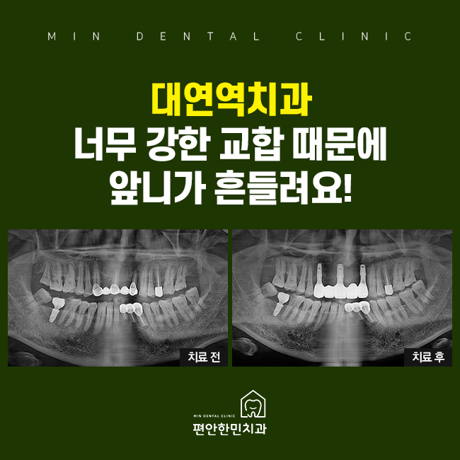 편안한민치과 이미지