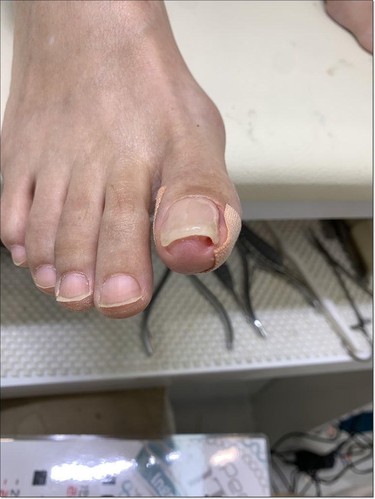 미엘네일 이미지