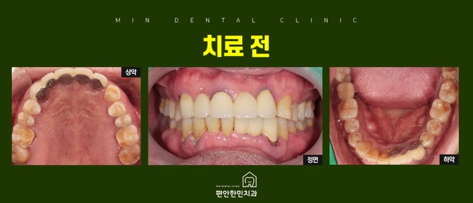 편안한민치과 이미지