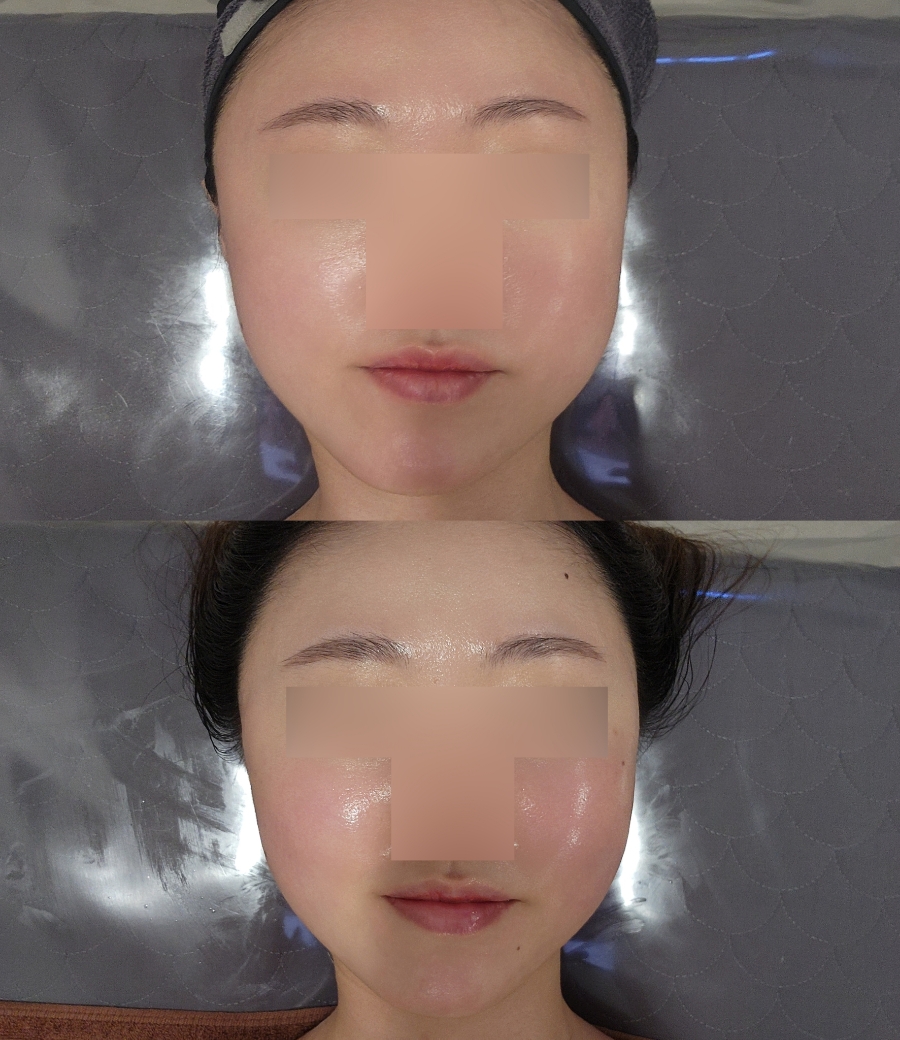 유니피부샵 이미지