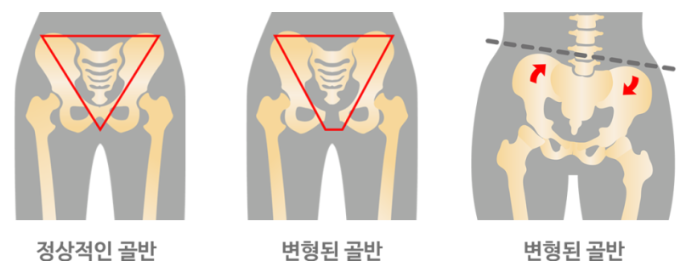 탑클래스짐 이미지