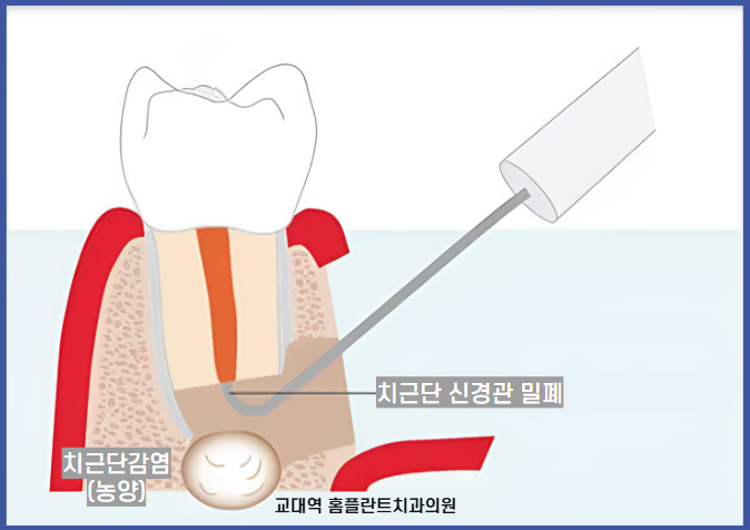 홈플란트치과의원 이미지