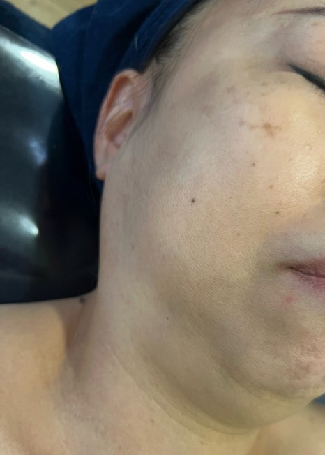 비움채뷰티아비스 이미지