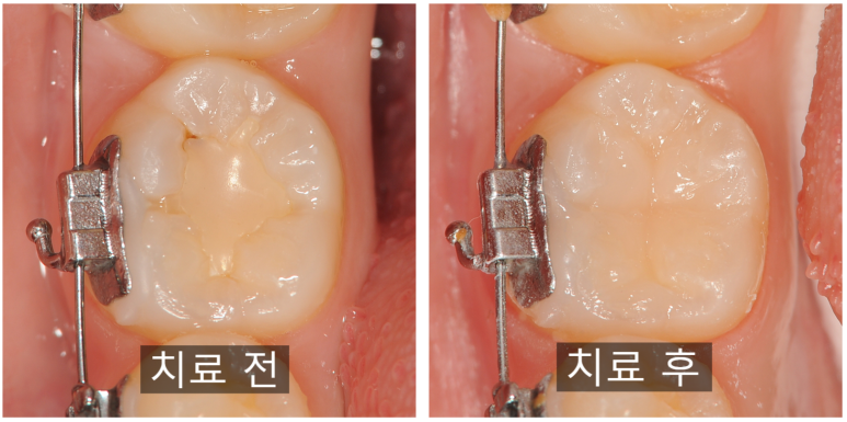 다봄치과 이미지