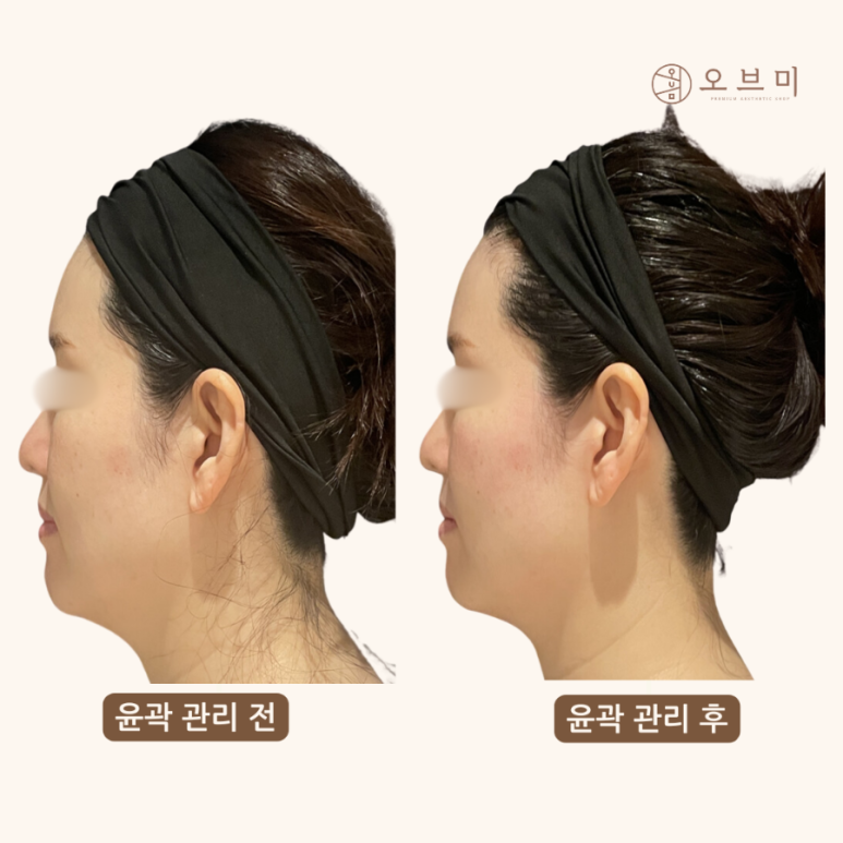 오브마곡 이미지