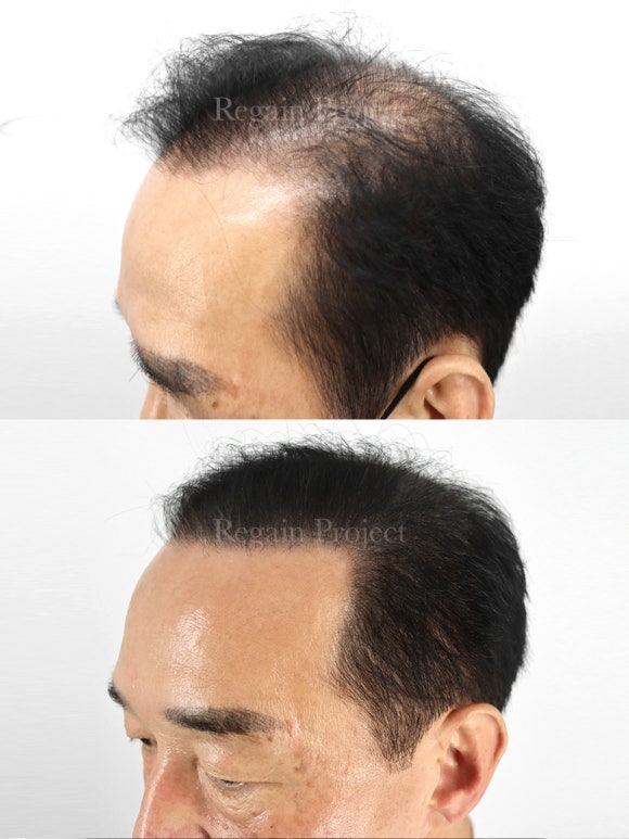 전주동안가발 이미지