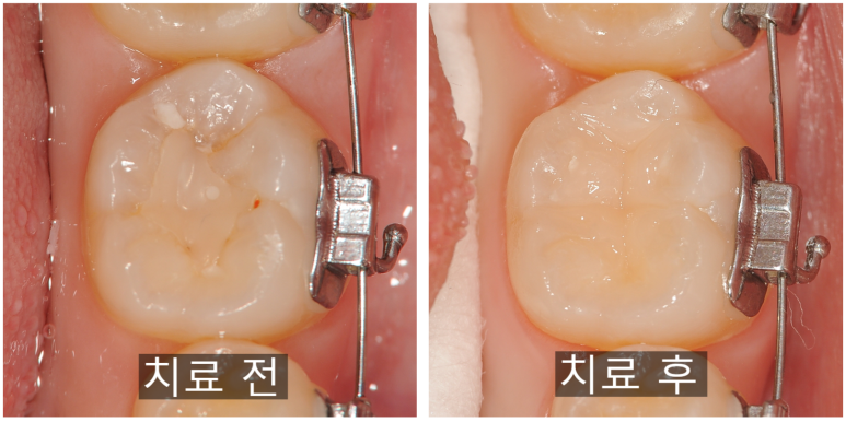 다봄치과 이미지