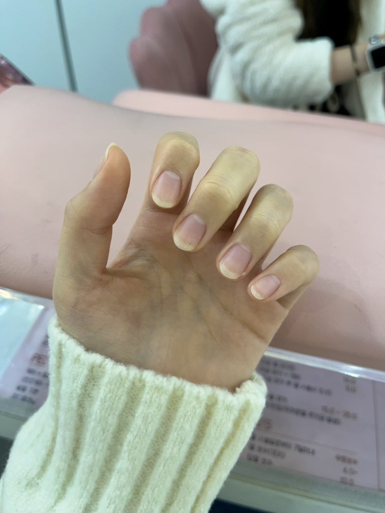 전처리왕 이미지
