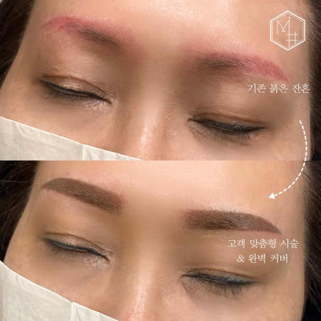 미샵스킨케어 이미지