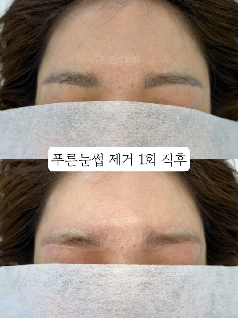 브로우주 이미지
