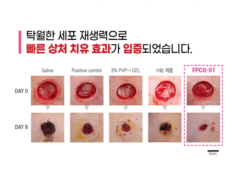 (주)퍼슨헬스케어 이미지